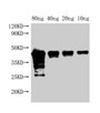 Western Blot; Positive WB detected in Recombinant protein; All lanes: Met antibody at 1:2000; Secondary; Goat polyclonal to rabbit IgG at 1/50000 dilution; Predicted band size: 42 kDa; Observed band size: 45 kDa; Western Blot; Positive WB detected in Recombinant protein; All lanes: Met antibody at 1:2000; Secondary; Goat polyclonal to rabbit IgG at 1/50000 dilution; Predicted band size: 42 kDa; Observed band size: 45 kDa;