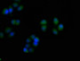 Immunofluorescence staining of Hela cells with CAC11694 at 1:50, counter-stained with DAPI. The cells were fixed in 4% formaldehyde, permeabilized using 0.2% Triton X-100 and blocked in 10% normal Goat Serum. The cells were then incubated with the antibody overnight at 4°C. The secondary antibody was Alexa Fluor 488-congugated AffiniPure Goat Anti-Rabbit IgG(H+L). Immunofluorescence staining of Hela cells with CAC11694 at 1:50, counter-stained with DAPI. The cells were fixed in 4% formaldehyde, permeabilized using 0.2% Triton X-100 and blocked in 10% normal Goat Serum. The cells were then incubated with the antibody overnight at 4°C. The secondary antibody was Alexa Fluor 488-congugated AffiniPure Goat Anti-Rabbit IgG(H+L).
