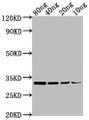 Western Blot; Positive WB detected in Recombinant protein; All lanes: omp antibody at 1:2000; Secondary; Goat polyclonal to rabbit IgG at 1/50000 dilution; Predicted band size: 32 kDa; Observed band size: 32 kDa;