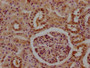 IHC image diluted at 1:100 and staining in paraffin-embedded human kidney tissue performed on a Leica BondTM system. After dewaxing and hydration, antigen retrieval was mediated by high pressure in a citrate buffer (pH 6.0). Section was blocked with 10% normal goat serum 30min at RT. Then primary antibody (1% BSA) was incubated at 4°C overnight. The primary is detected by a biotinylated secondary antibody and visualized using an HRP conjugated SP system.