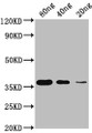 Western Blot; Positive WB detected in Recombinant protein; All lanes: Copper-metallothionein antibody at 1:2000; Secondary; Goat polyclonal to rabbit IgG at 1/50000 dilution; Predicted band size: 35 KDa; Observed band size: 35 KDa;