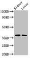 Western Blot; Positive WB detected in: Rat kidney tissue, Mouse liver tissue; All lanes: TAF8 antibody at 2.5µg/ml; Secondary; Goat polyclonal to rabbit IgG at 1/50000 dilution; Predicted band size: 35, 38 kDa; Observed band size: 38 kDa;