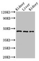 Western Blot; Positive WB detected in: Rat kidney tissue, Rat liver tissue, Mouse kidney tissue; All lanes: MKRN2 antibody at 3µg/ml; Secondary; Goat polyclonal to rabbit IgG at 1/50000 dilution; Predicted band size: 47, 42 kDa; Observed band size: 47 kDa;