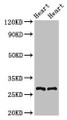 Western Blot; Positive WB detected in: Rat heart tissue, Mouse heart tissue; All lanes: MYF5 antibody at 2.5µg/ml; Secondary; Goat polyclonal to rabbit IgG at 1/50000 dilution; Predicted band size: 29 kDa; Observed band size: 29 kDa;