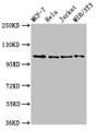 Western Blot; Positive WB detected in: MCF-7 whole cell lysate, Hela whole cell lysate, Jurkat whole cell lysate, NIH/3T3 whole cell lysate; All lanes: EPHB3 antibody at 2.7µg/ml; Secondary; Goat polyclonal to rabbit IgG at 1/50000 dilution; Predicted band size: 111 kDa; Observed band size: 111 kDa; Western Blot; Positive WB detected in: MCF-7 whole cell lysate, Hela whole cell lysate, Jurkat whole cell lysate, NIH/3T3 whole cell lysate; All lanes: EPHB3 antibody at 2.7µg/ml; Secondary; Goat polyclonal to rabbit IgG at 1/50000 dilution; Predicted band size: 111 kDa; Observed band size: 111 kDa;