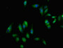 Immunofluorescent analysis of Hela cells using CAC11723 at dilution of 1:100 and Alexa Fluor 488-congugated AffiniPure Goat Anti-Rabbit IgG(H+L) Immunofluorescent analysis of Hela cells using CAC11723 at dilution of 1:100 and Alexa Fluor 488-congugated AffiniPure Goat Anti-Rabbit IgG(H+L)