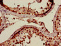 Immunohistochemistry of paraffin-embedded human testis tissue using CAC11726 at dilution of 1:100 Immunohistochemistry of paraffin-embedded human testis tissue using CAC11726 at dilution of 1:100