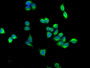 Immunofluorescence staining of PC-3 cells with CAC11726 at 1:166,counter-stained with DAPI. The cells were fixed in 4% formaldehyde, permeabilized using 0.2% Triton X-100 and blocked in 10% normal Goat Serum. The cells were then incubated with the antibody overnight at 4°C.The secondary antibody was Alexa Fluor 488-congugated AffiniPure Goat Anti-Rabbit IgG (H+L). Immunofluorescence staining of PC-3 cells with CAC11726 at 1:166,counter-stained with DAPI. The cells were fixed in 4% formaldehyde, permeabilized using 0.2% Triton X-100 and blocked in 10% normal Goat Serum. The cells were then incubated with the antibody overnight at 4°C.The secondary antibody was Alexa Fluor 488-congugated AffiniPure Goat Anti-Rabbit IgG (H+L).