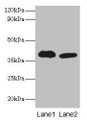Western blot; All lanes: Adh5 antibody at 2µg/ml; Lane 1: Mouse liver tissue; Lane 2: Mouse kidney tissue; Secondary; Goat polyclonal to rabbit IgG at 1/10000 dilution; Predicted band size: 40 kDa; Observed band size: 40 kDa Western blot; All lanes: Adh5 antibody at 2µg/ml; Lane 1: Mouse liver tissue; Lane 2: Mouse kidney tissue; Secondary; Goat polyclonal to rabbit IgG at 1/10000 dilution; Predicted band size: 40 kDa; Observed band size: 40 kDa