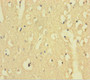 Immunohistochemistry of paraffin-embedded human brain tissue using CAC11736 at dilution of 1:100
