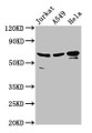 Western Blot; Positive WB detected in: Jurkat whole cell lysate, A549 whole cell lysate, Hela whole cell lysate; All lanes: AIFM1 antibody at 2.8µg/ml; Secondary; Goat polyclonal to rabbit IgG at 1/50000 dilution; Predicted band size: 67, 36, 29, 27 kDa; Observed band size: 67 kDa Western Blot; Positive WB detected in: Jurkat whole cell lysate, A549 whole cell lysate, Hela whole cell lysate; All lanes: AIFM1 antibody at 2.8µg/ml; Secondary; Goat polyclonal to rabbit IgG at 1/50000 dilution; Predicted band size: 67, 36, 29, 27 kDa; Observed band size: 67 kDa