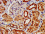 IHC image diluted at 1:1400 and staining in paraffin-embedded human kidney tissue performed on a Leica BondTM system. After dewaxing and hydration, antigen retrieval was mediated by high pressure in a citrate buffer (pH 6.0). Section was blocked with 10% normal goat serum 30min at RT. Then primary antibody (1% BSA) was incubated at 4°C overnight. The primary is detected by a biotinylated secondary antibody and visualized using an HRP conjugated SP system. IHC image diluted at 1:1400 and staining in paraffin-embedded human kidney tissue performed on a Leica BondTM system. After dewaxing and hydration, antigen retrieval was mediated by high pressure in a citrate buffer (pH 6.0). Section was blocked with 10% normal goat serum 30min at RT. Then primary antibody (1% BSA) was incubated at 4°C overnight. The primary is detected by a biotinylated secondary antibody and visualized using an HRP conjugated SP system.