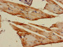 Immunohistochemistry of paraffin-embedded human skeletal muscle tissue using CAC11739 at dilution of 1:100