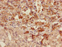 Immunohistochemistry of paraffin-embedded human adrenal gland tissue using CAC11740 at dilution of 1:100
