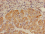 Immunohistochemistry of paraffin-embedded human adrenal gland tissue using CAC11742 at dilution of 1:100