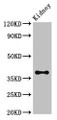 Western Blot; Positive WB detected in: Mouse kidney tissue; All lanes: Atoh1 antibody at 3.4µg/ml; Secondary; Goat polyclonal to rabbit IgG at 1/50000 dilution; Predicted band size: 38 kDa; Observed band size: 38 kDa Western Blot; Positive WB detected in: Mouse kidney tissue; All lanes: Atoh1 antibody at 3.4µg/ml; Secondary; Goat polyclonal to rabbit IgG at 1/50000 dilution; Predicted band size: 38 kDa; Observed band size: 38 kDa