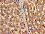 Immunohistochemistry of paraffin-embedded human liver tissue using CAC11769 at dilution of 1:100