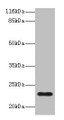Western blot; All lanes: C8G antibody at 2µg/ml + Human serum; Secondary; Goat polyclonal to rabbit IgG at 1/10000 dilution; Predicted band size: 23 kDa; Observed band size: 23 kDa