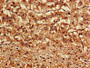 Immunohistochemistry of paraffin-embedded human adrenal gland tissue using CAC11784 at dilution of 1:100