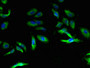 Immunofluorescent analysis of Hela cells using CAC11785 at dilution of 1:100 and Alexa Fluor 488-congugated AffiniPure Goat Anti-Rabbit IgG(H+L)