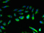 Immunofluorescent analysis of Hela cells using CAC11789 at dilution of 1:100 and Alexa Fluor 488-congugated AffiniPure Goat Anti-Rabbit IgG(H+L)