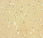 Immunohistochemistry of paraffin-embedded human brain tissue using CAC11794 at dilution of 1:100