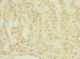 Immunohistochemistry of paraffin-embedded human adrenal gland tissue using CAC11798 at dilution of 1:100