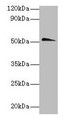 Western blot; All lanes: Chrna1 antibody at 2µg/ml + Hela whole lysate; Secondary; Goat polyclonal to rabbit IgG at 1/10000 dilution; Predicted band size: 52 kDa; Observed band size: 52 kDa