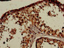 Immunohistochemistry of paraffin-embedded human testis tissue using CAC11809 at dilution of 1:100 Immunohistochemistry of paraffin-embedded human testis tissue using CAC11809 at dilution of 1:100