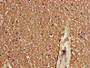 Immunohistochemistry of paraffin-embedded human brain tissue using CAC11809 at dilution of 1:100 Immunohistochemistry of paraffin-embedded human brain tissue using CAC11809 at dilution of 1:100