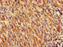 Immunohistochemistry of paraffin-embedded human liver cancer using CAC11812 at dilution of 1:100