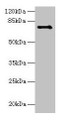 Western blot; All lanes: Ctcfl antibody at 6µg/ml + Hela whole cell lysate; Secondary; Goat polyclonal to rabbit IgG at 1/10000 dilution; Predicted band size: 74, 75 kDa; Observed band size: 74 kDa