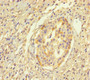 Immunohistochemistry of paraffin-embedded human pancreatic cancer using CAC11821 at dilution of 1:100