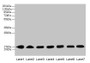 Western blot; All lanes: CYB5B antibody at 0.8µg/ml; Lane 1: HepG2 whole cell lysate; Lane 2: Mouse liver tissue; Lane 3: Mouse heart tissue; Lane 4: Hela whole cell lysate; Lane 5: U87 whole cell lysate; Lane 6: EC109 whole cell lysate; Lane 7: A549 whole cell lysate; Secondary; Goat polyclonal to rabbit IgG at 1/10000 dilution; Predicted band size: 17 kDa; Observed band size: 17 kDa