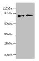 Western blot; All lanes: ECD antibody at 6µg/ml; Lane 1: Hela whole cell lysate; Lane 2: U251 whole cell lysate; Secondary; Goat polyclonal to rabbit IgG at 1/10000 dilution; Predicted band size: 73, 68, 77 kDa; Observed band size: 73 kDa