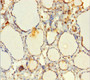 Immunohistochemistry of paraffin-embedded human thyroid tissue using CAC11842 at dilution of 1:100