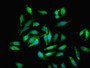Immunofluorescent analysis of Hela cells using CAC11842 at dilution of 1:100 and Alexa Fluor 488-congugated AffiniPure Goat Anti-Rabbit IgG(H+L)