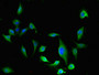 Immunofluorescent analysis of U251 cells using CAC11845 at dilution of 1:100 and Alexa Fluor 488-congugated AffiniPure Goat Anti-Rabbit IgG(H+L)