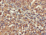 Immunohistochemistry of paraffin-embedded human adrenal gland tissue using CAC11855 at dilution of 1:100