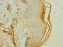 Immunohistochemistry of paraffin-embedded human skin tissue using CAC11861 at dilution of 1:100 Immunohistochemistry of paraffin-embedded human skin tissue using CAC11861 at dilution of 1:100