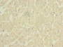 Immunohistochemistry of paraffin-embedded human heart tissue using CAC11862 at dilution of 1:100