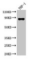 Western Blot; ,Positive WB detected in: THP-1 whole cell lysate; ,All lanes: GSN antibody at 3.5µg/ml; ,Secondary; ,Goat polyclonal to rabbit IgG at 1/50000 dilution; ,Predicted band size: 86, 81, 82 kDa; ,Observed band size: 86 kDa