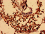 Immunohistochemistry analysis of human testis tissue using CAC11888 at dilution of 1:100 Immunohistochemistry analysis of human testis tissue using CAC11888 at dilution of 1:100