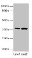 Western blot; All lanes: C1GALT1C1 antibody at 3.97µg/ml; Lane 1: Mouse gonadal tissue; Lane 2: Mouse liver tissue; Secondary; Goat polyclonal to rabbit IgG at 1/10000 dilution; Predicted band size: 36 kDa; Observed band size: 36 kDa; Western blot; All lanes: C1GALT1C1 antibody at 3.97µg/ml; Lane 1: Mouse gonadal tissue; Lane 2: Mouse liver tissue; Secondary; Goat polyclonal to rabbit IgG at 1/10000 dilution; Predicted band size: 36 kDa; Observed band size: 36 kDa;