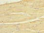 Immunohistochemistry of paraffin-embedded human skeletal muscle tissue using CAC11902 at dilution of 1:100
