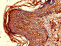Immunohistochemistry of paraffin-embedded human skin tissue using CAC11907 at dilution of 1:100 Immunohistochemistry of paraffin-embedded human skin tissue using CAC11907 at dilution of 1:100