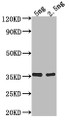 Western Blot; Positive WB detected in Recombinant protein; All lanes: fimA antibody at 1:2000; Secondary; Goat polyclonal to rabbit IgG at 1/50000 dilution; Predicted band size: 31.8 kDa; Observed band size: 36 kDa; Western Blot; Positive WB detected in Recombinant protein; All lanes: fimA antibody at 1:2000; Secondary; Goat polyclonal to rabbit IgG at 1/50000 dilution; Predicted band size: 31.8 kDa; Observed band size: 36 kDa;