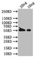 Western Blot, Positive WB detected in Recombinant proteinAll lanes: BZLF1 antibody at 1:1000SecondaryGoat polyclonal to rabbit IgG at 1/50000 dilutionPredicted band size: 46 kDaObserved band size: 50 kDa Western Blot, Positive WB detected in Recombinant proteinAll lanes: BZLF1 antibody at 1:1000SecondaryGoat polyclonal to rabbit IgG at 1/50000 dilutionPredicted band size: 46 kDaObserved band size: 50 kDa