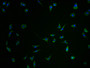 Immunofluorescence staining of SH-SY5Y cells with CAC12815 at 1:100, counter-stained with DAPI. The cells were fixed in 4% formaldehyde and blocked in 10% normal Goat Serum. The cells were then incubated with the antibody overnight at 4°C. The secondary antibody was Alexa Fluor 488-congugated AffiniPure Goat Anti-Rabbit IgG(H+L). Immunofluorescence staining of SH-SY5Y cells with CAC12815 at 1:100, counter-stained with DAPI. The cells were fixed in 4% formaldehyde and blocked in 10% normal Goat Serum. The cells were then incubated with the antibody overnight at 4°C. The secondary antibody was Alexa Fluor 488-congugated AffiniPure Goat Anti-Rabbit IgG(H+L).
