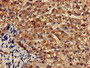 Immunohistochemistry of paraffin-embedded human liver tissue using CAC12823 at dilution of 1:100 Immunohistochemistry of paraffin-embedded human liver tissue using CAC12823 at dilution of 1:100